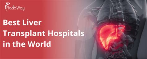 Top 10 Liver Transplant Hospitals in the World .